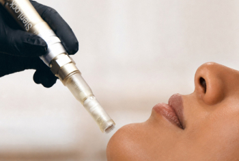 SkinHealth Systems Launches SkinStylus® SteriLock MicroSystem in the UK & International Markets