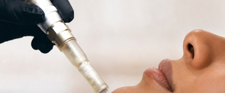 SkinHealth Systems Launches SkinStylus® SteriLock MicroSystem in the UK & International Markets